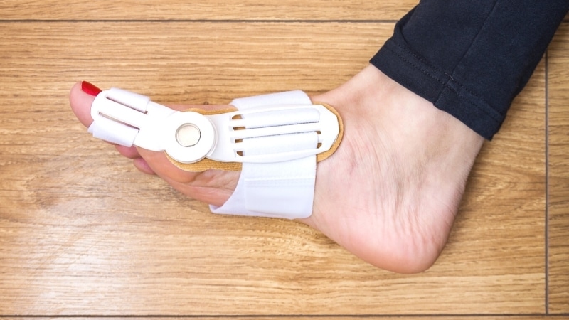 Hallux-Valgus-Schiene-anlegen