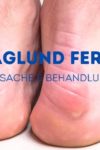 haglund-ferse